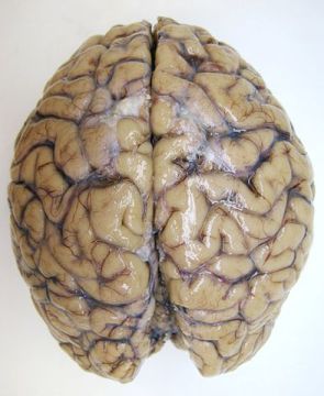 A human brain: slimy, white-ish, wrinkled, and pretty gross-looking.